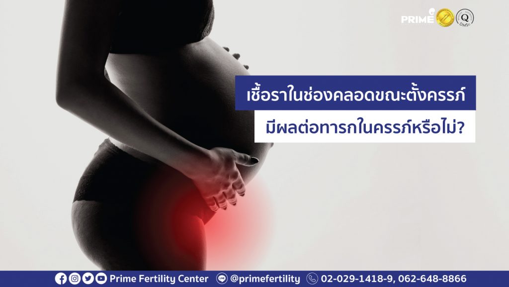 เชื้อราในช่องคลอด web