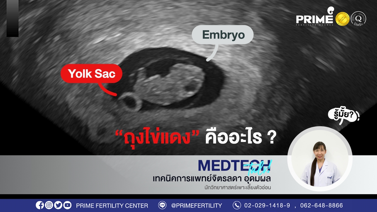 ไข่แดง ขึ้นเว็บ