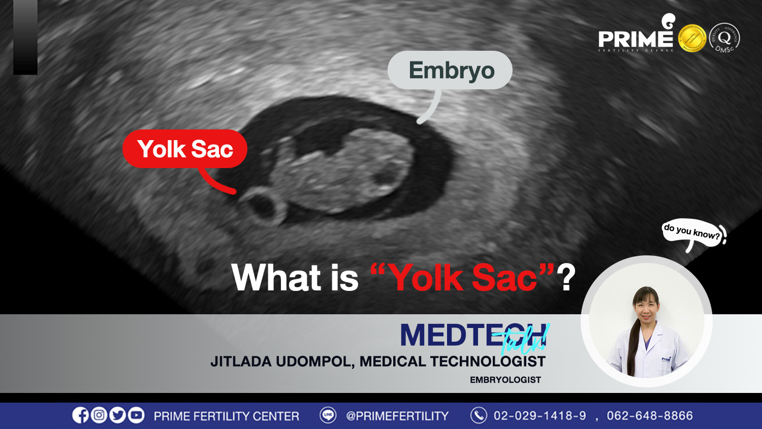 disgusting yawning dealer What is “ Yolk Sac ”? | Prime Fertility Clinic