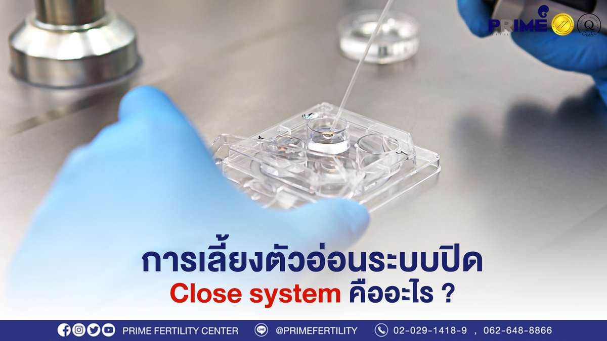 การเลี้ยงตัวอ่อนระบบปิด (Close system) คืออะไร?