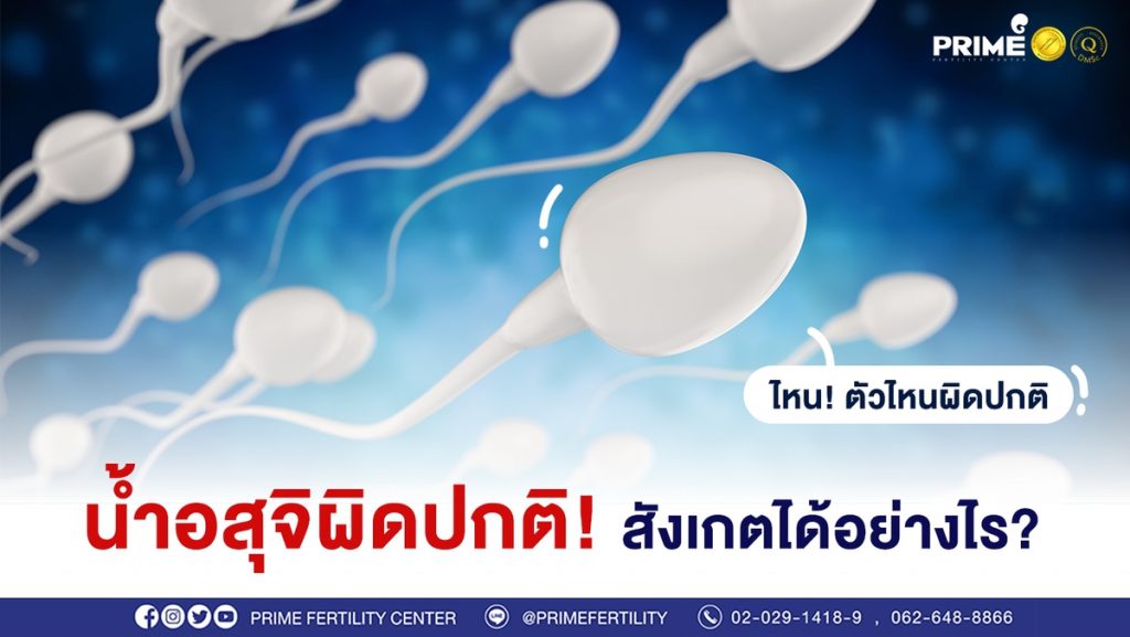 น้ำอสุจิผิดปกติ ขึ้นเว็บ
