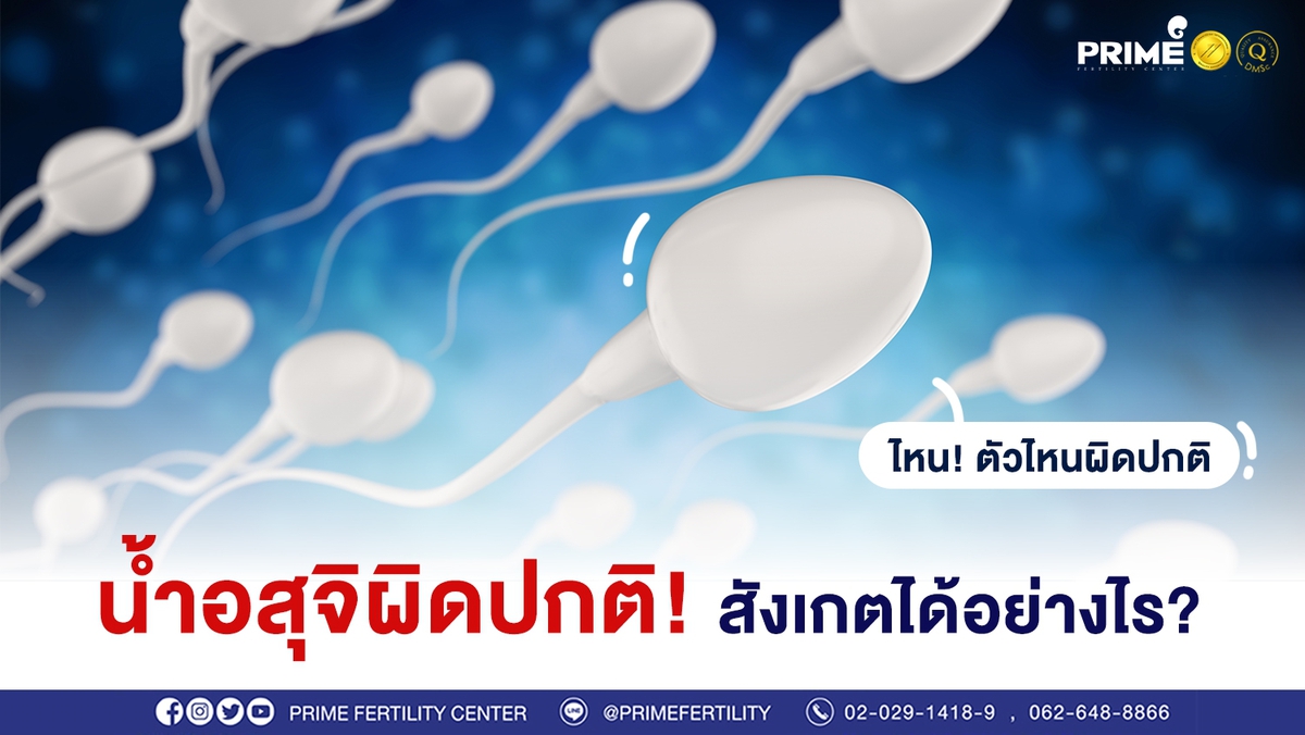 น้ำอสุจิผิดปกติ ขึ้นเว็บ