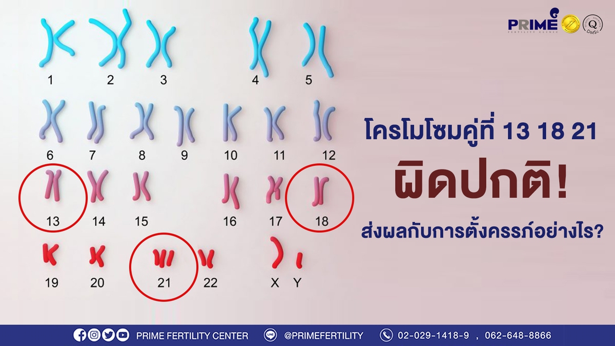 โครโมโซมคู่ที่ 13 18 21 ขึ้นเว็บ