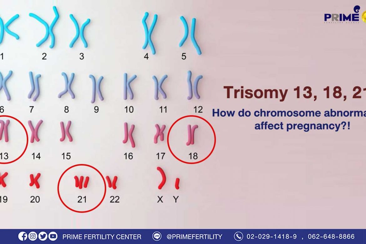 Trisomy 13, 18, 21! How do chromosome abnormalities affect pregnancy?!