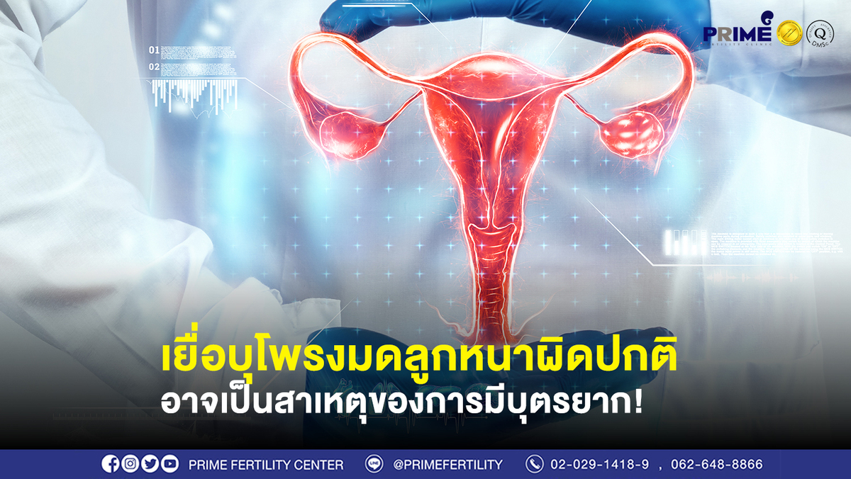 เยื่อบุโพรงมดลูกหนาผิดปกติ ขึ้นเว็บ 1