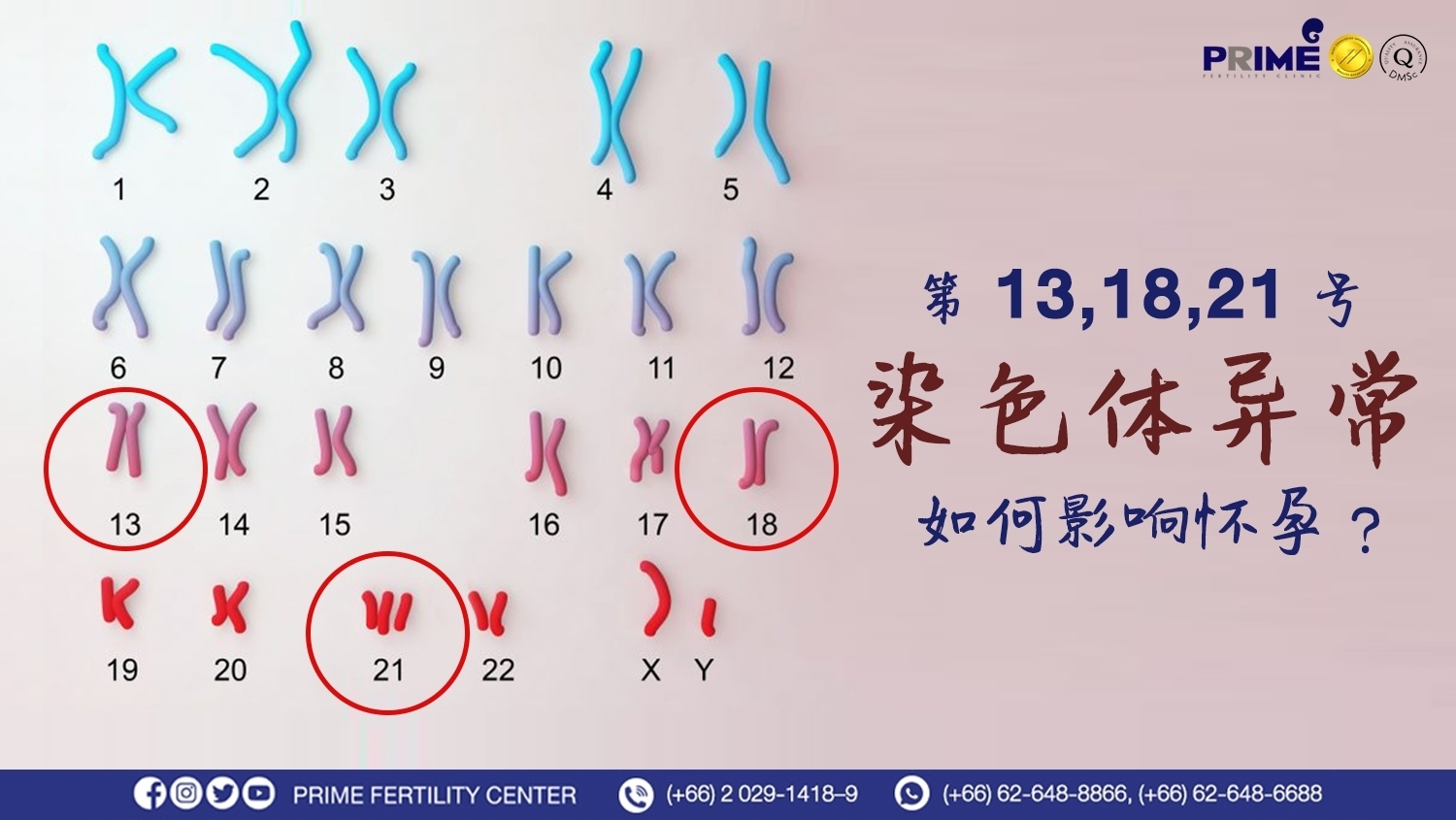  第13、18、21号染色体异常，如何影响怀孕？