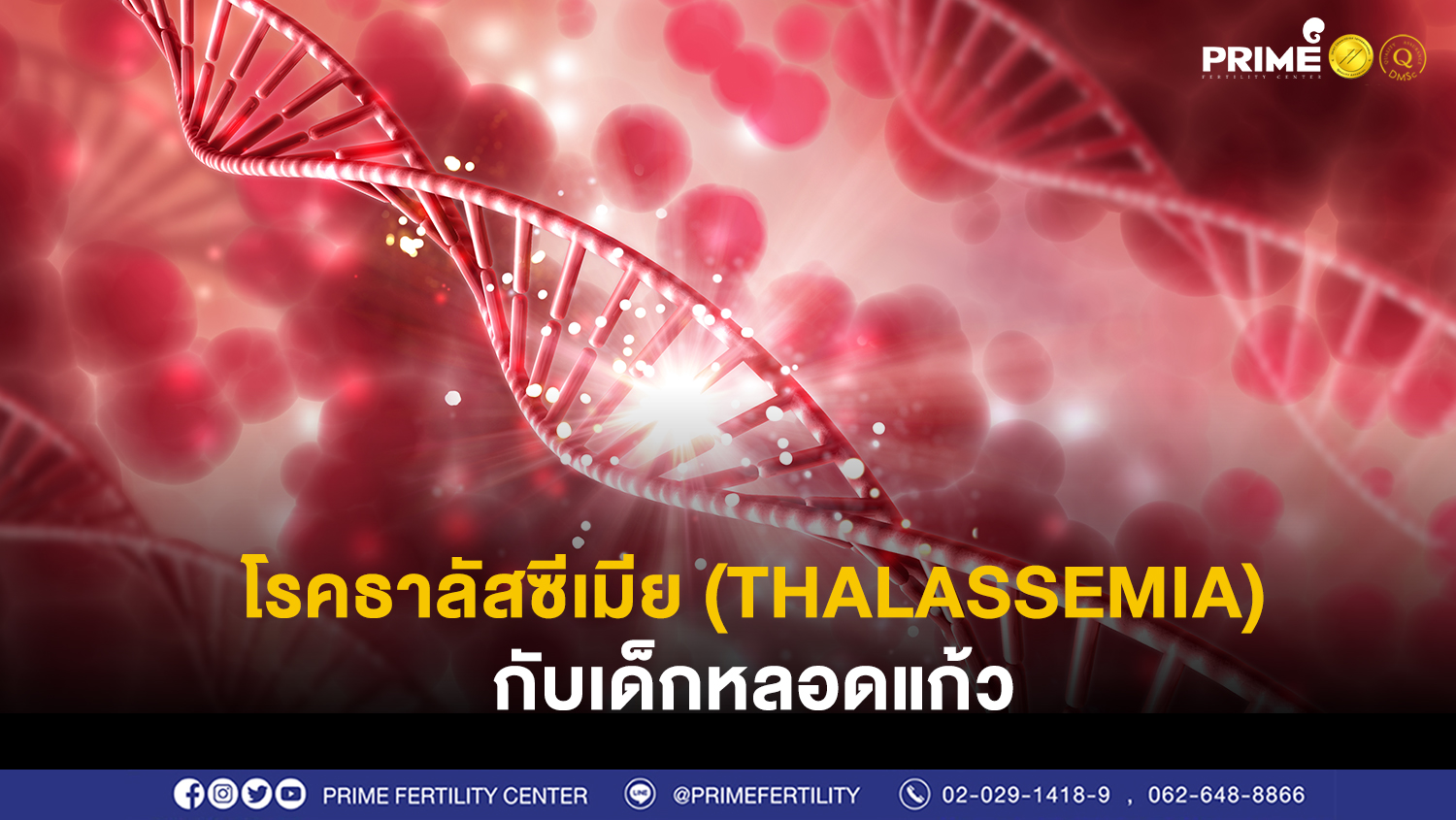 ทาลัสซีเมีย ขึ้นเว็บ