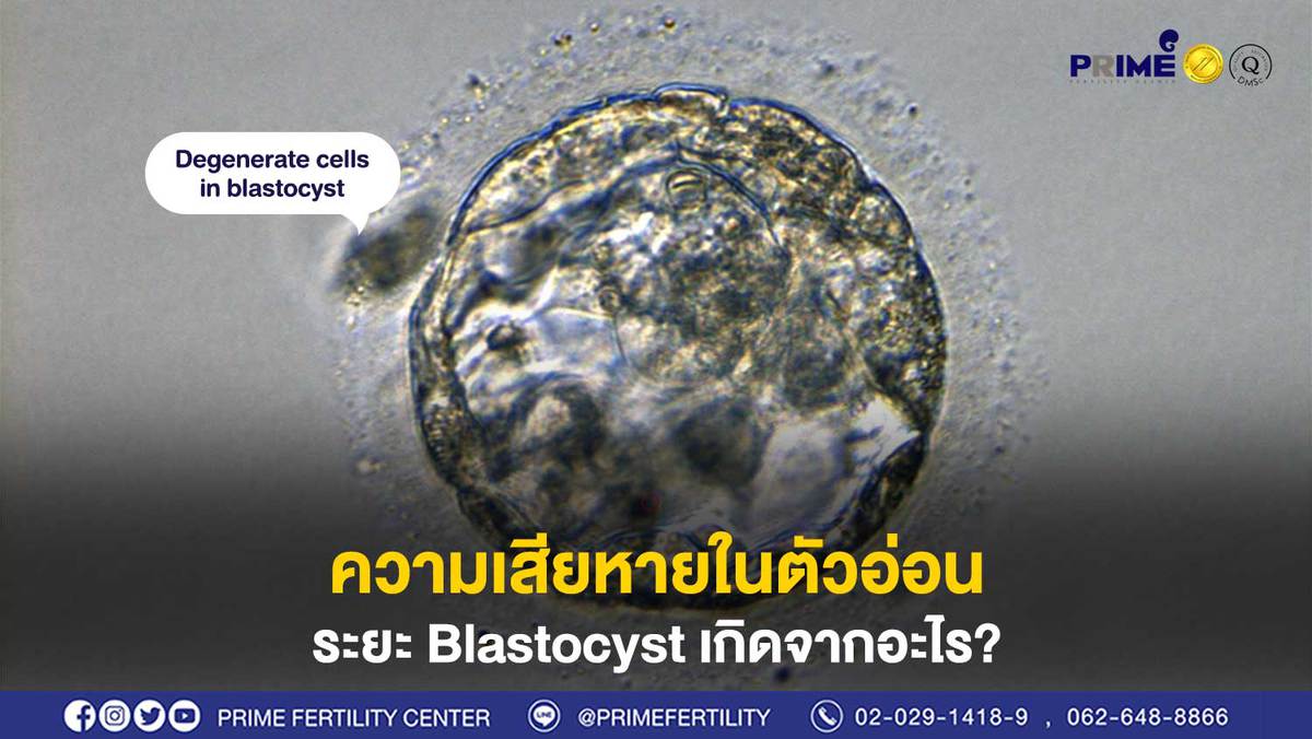 ความเสียหายในตัวอ่อนระยะ Blastocyst เกิดจากอะไร?