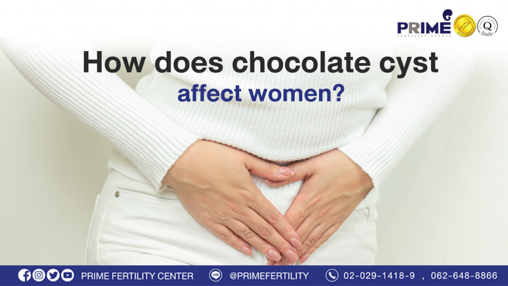 ช็อกโกแลตซีสต์ Chocolate Cyst web 1