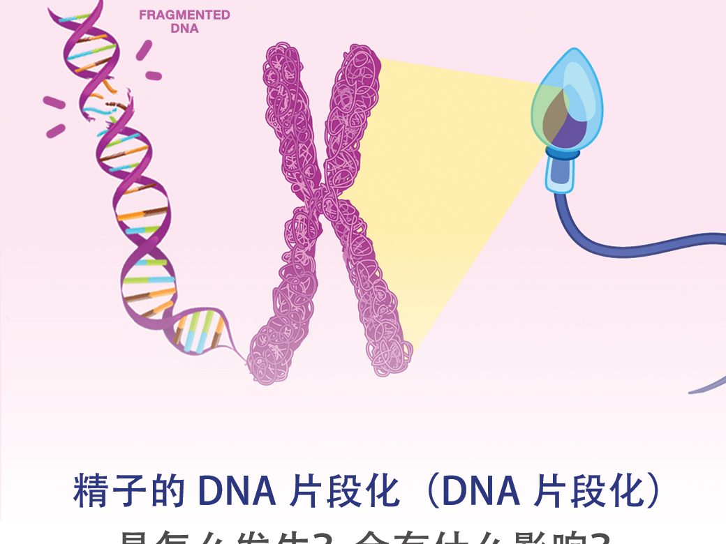 精子的 DNA 片段化（DNA 片段化） 是怎么发生？会有什么影响？