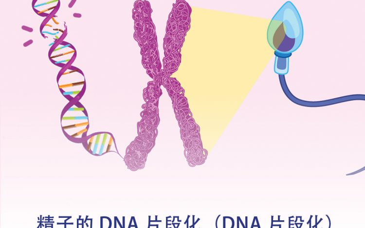 精子的 DNA 片段化（DNA 片段化） 是怎么发生？会有什么影响？