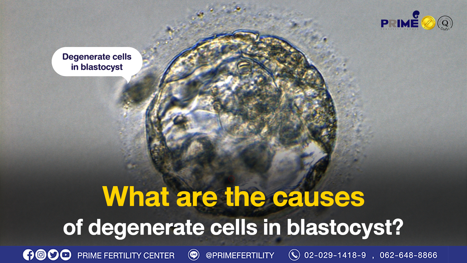 What are causes of degenerate cells in blastocyst?