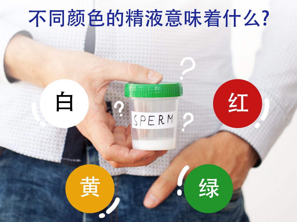 迷人的为什么射精是黄色的的照片