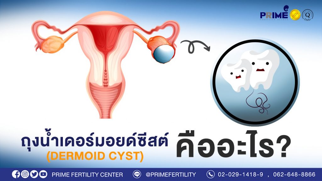 messageImage 1665822708050