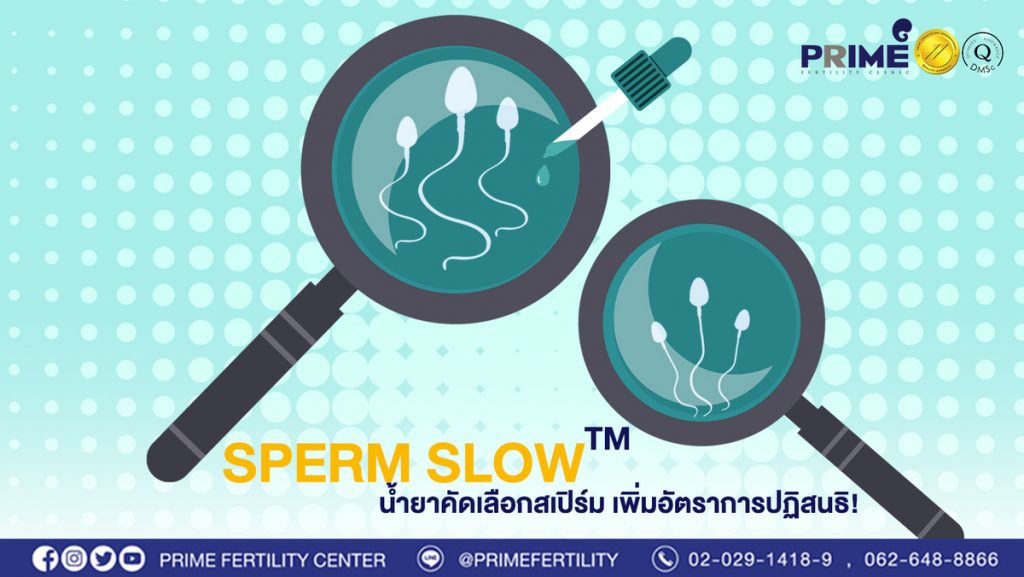 sperm web