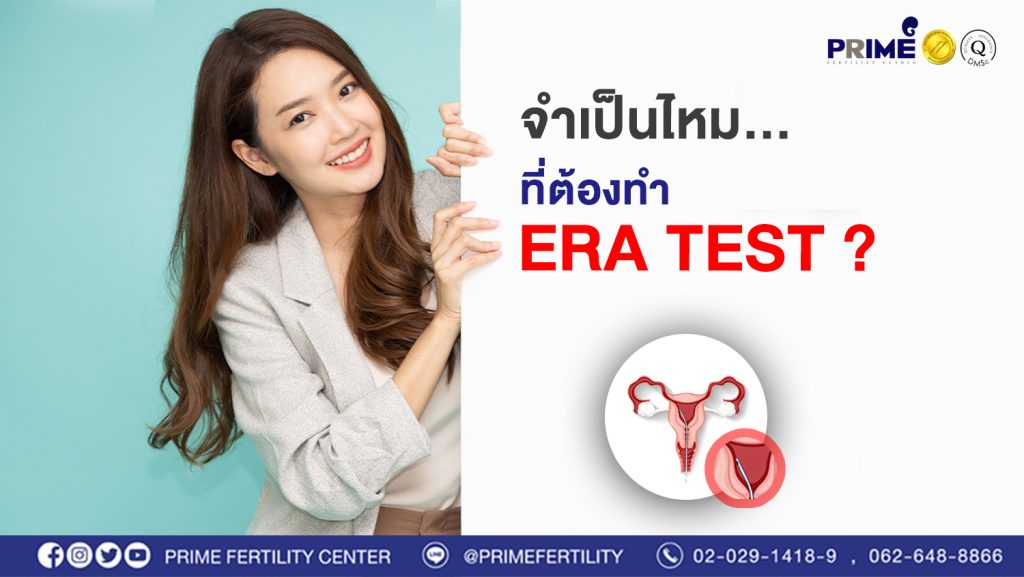 จำเป็นไหมที่ต้องทำ era test web