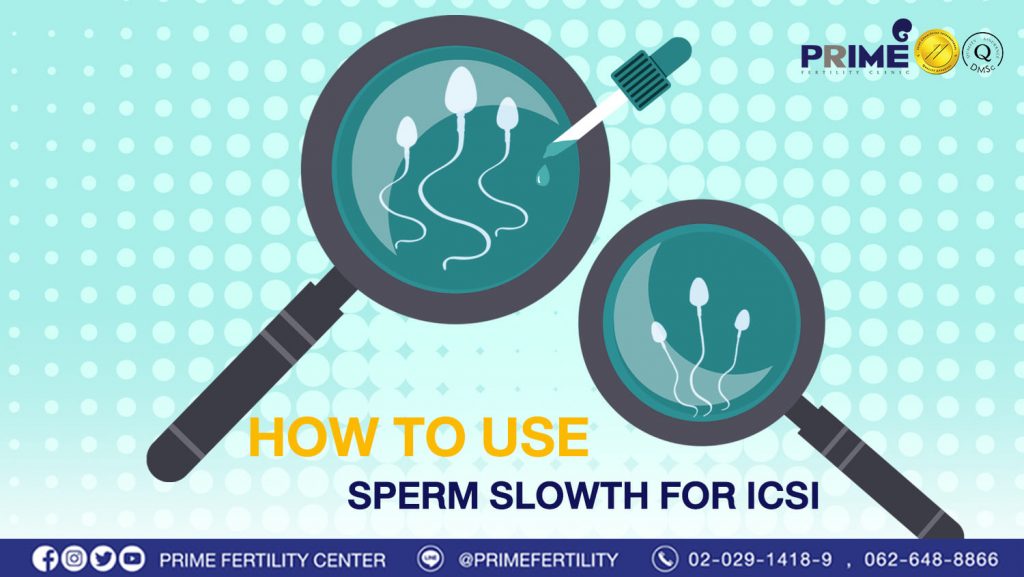SPERM SLOWTH, a selection of mature sperm, increases fertilization rate - Content Lab การนำ Sperm SlowTM มาใช้ในการทำ ICSI web Content Lab การนำ Sperm SlowTM มาใช้ในการทำ ICSI web