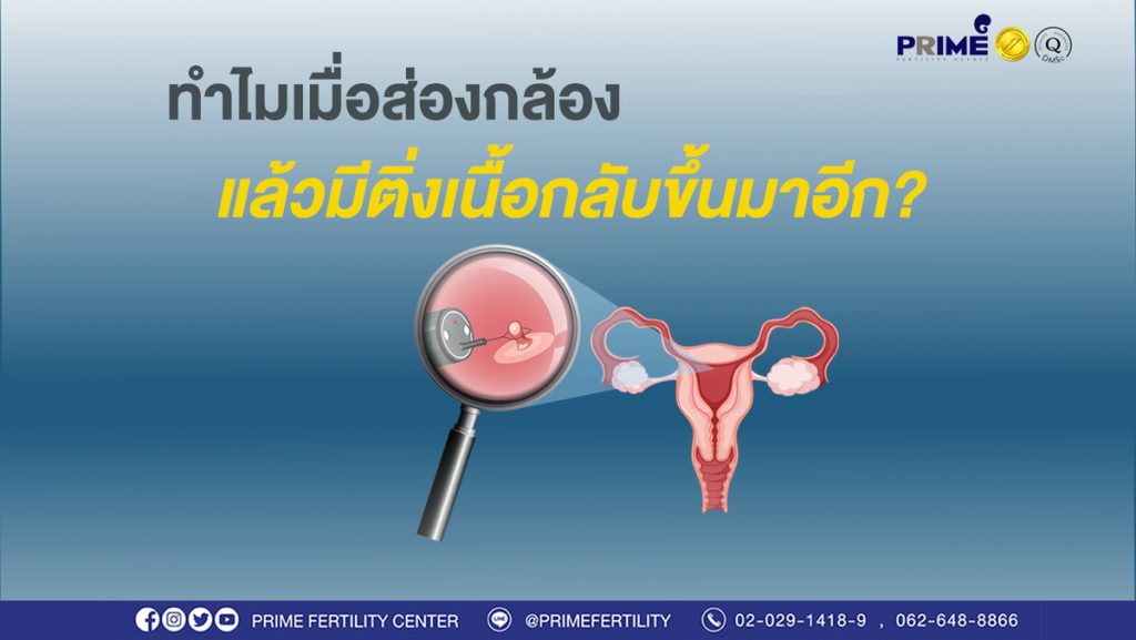 ส่องกล้องแล้วมีติ่งเนื้อกลับขึ้นมาอีก ขึ้นเว็บ