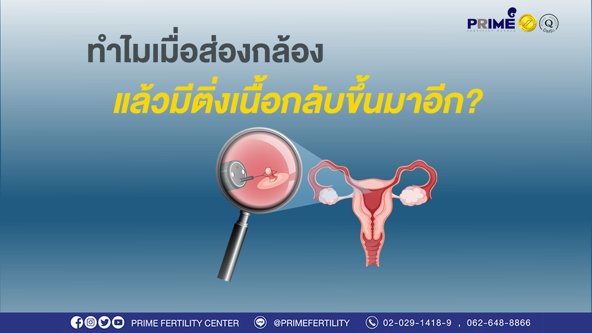 ส่องกล้องแล้วมีติ่งเนื้อกลับขึ้นมาอีก ขึ้นเว็บ