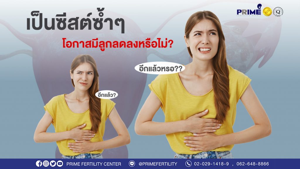 เป็นซีสต์ซ้ำๆ ขึ้นเว็บ