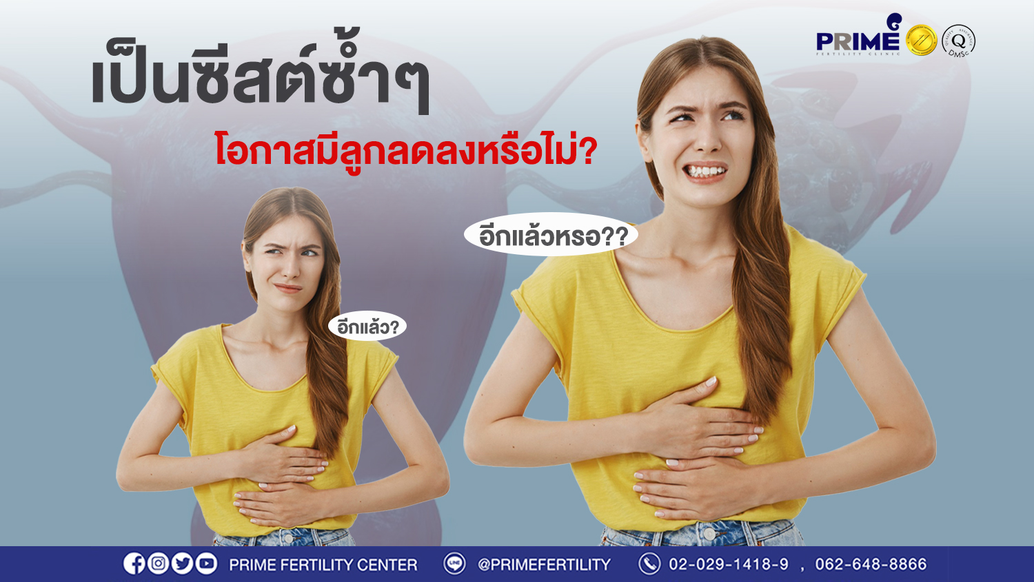เป็นซีสต์ซ้ำๆ ขึ้นเว็บ