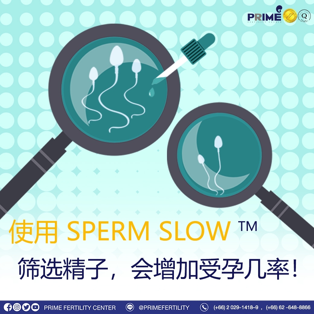 将 Sperm SlowTM 应用于第二代试管婴儿