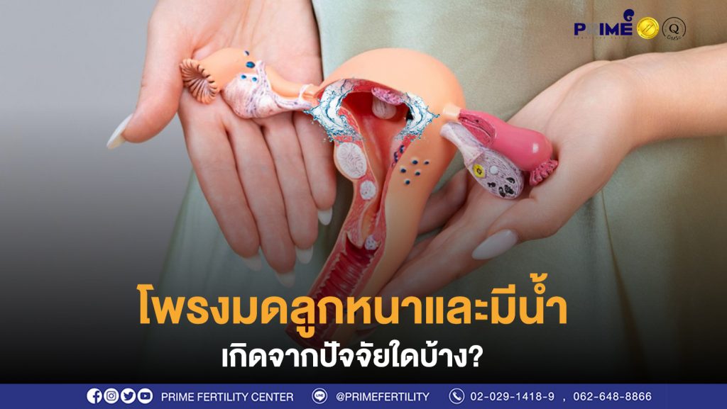 โพรงมดลูกมีน้ำ ขึ้นเว็บ