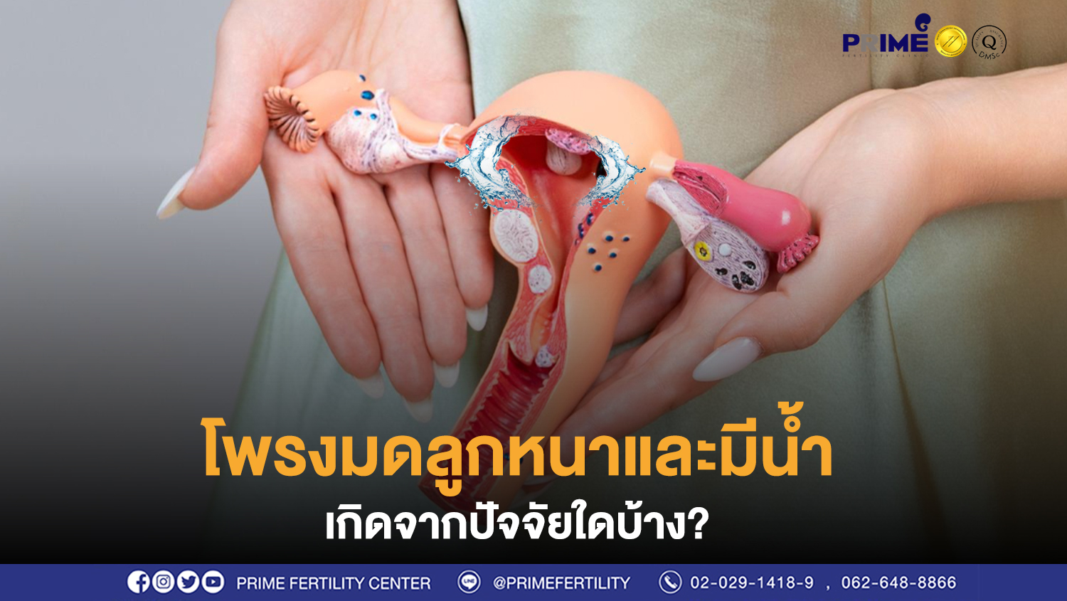 โพรงมดลูกมีน้ำ ขึ้นเว็บ