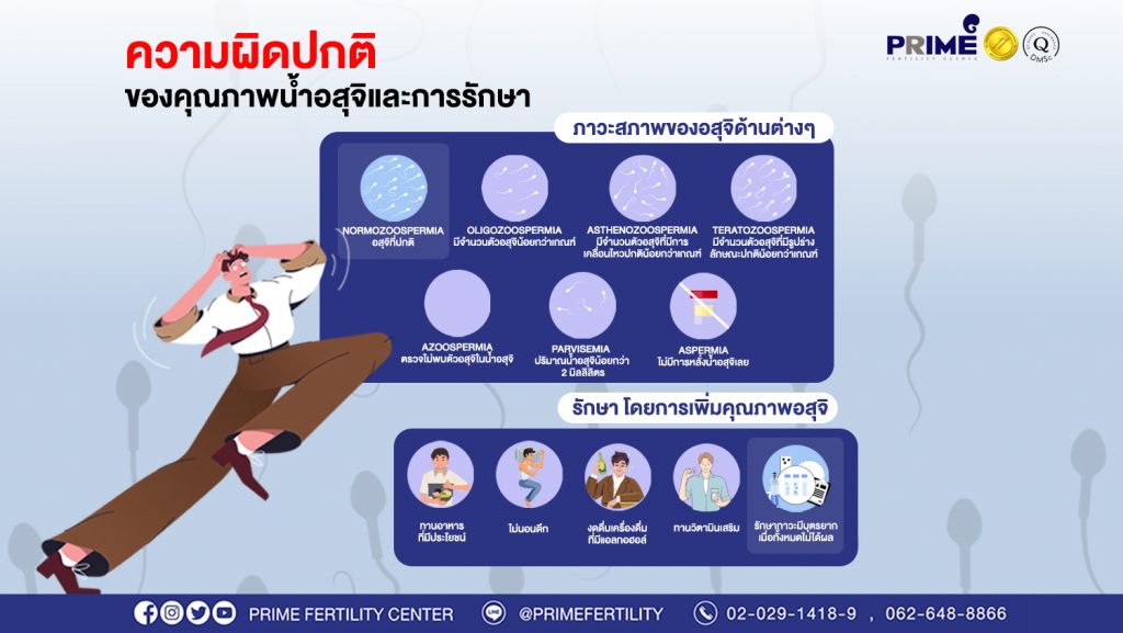 ความผิดปกติของคุณาพน้ำอสุจิและการรักษา ขึ้นเว็บ