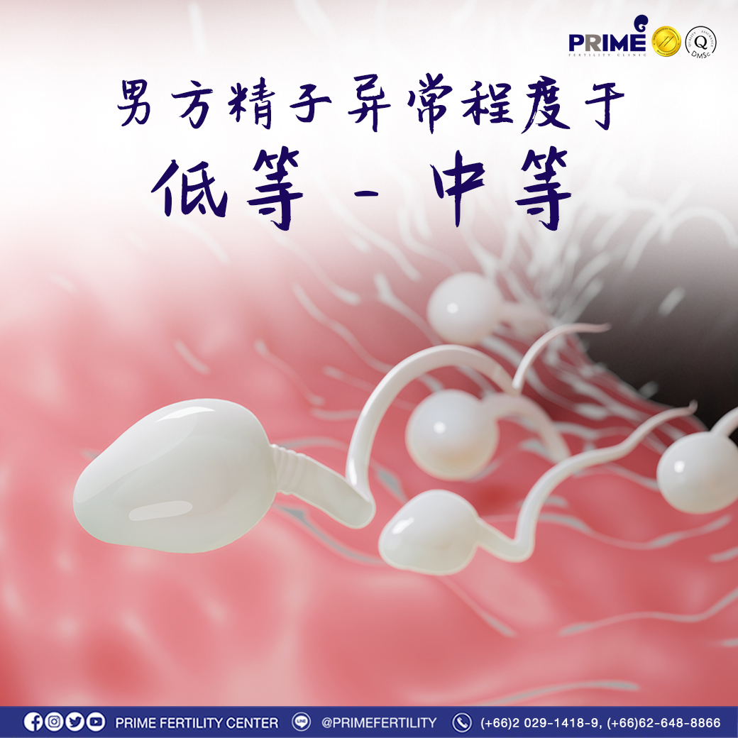 ฝ่ายชายอสุจิผิดปกติ