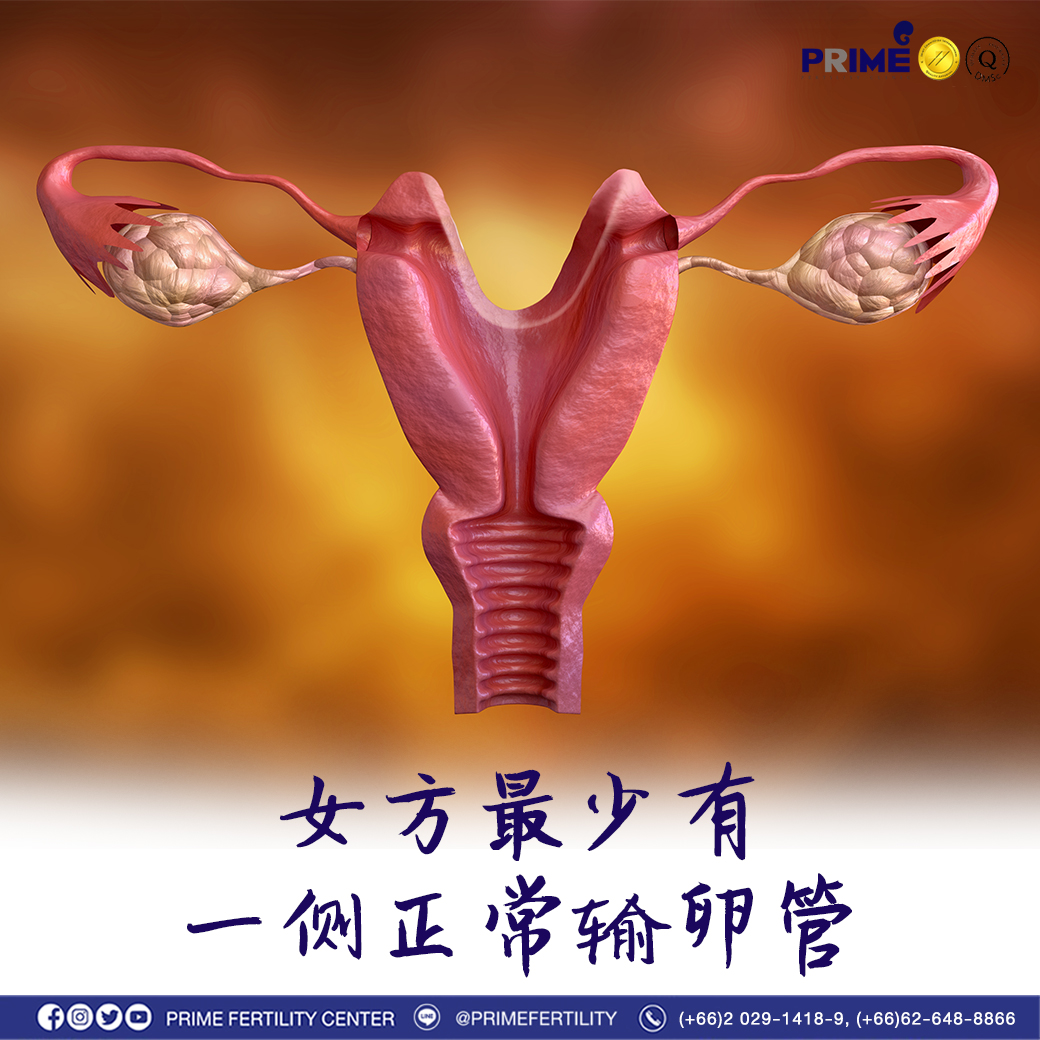 ฝ่ายหญิงมีท่อนำไข่ปกติ