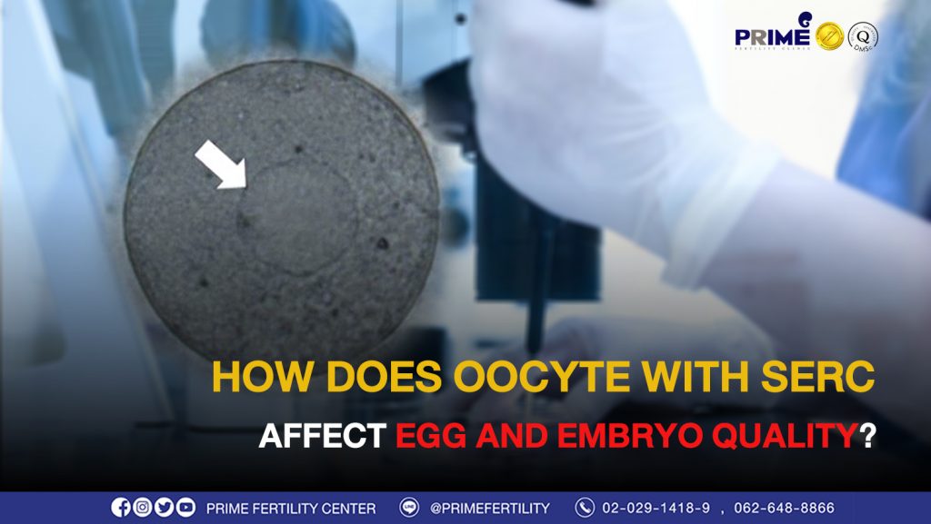 How does oocyte with SERC affect egg and embryo quality? - ไข่ที่มี SER ขึ้นเว็บ ไข่ที่มี SER ขึ้นเว็บ