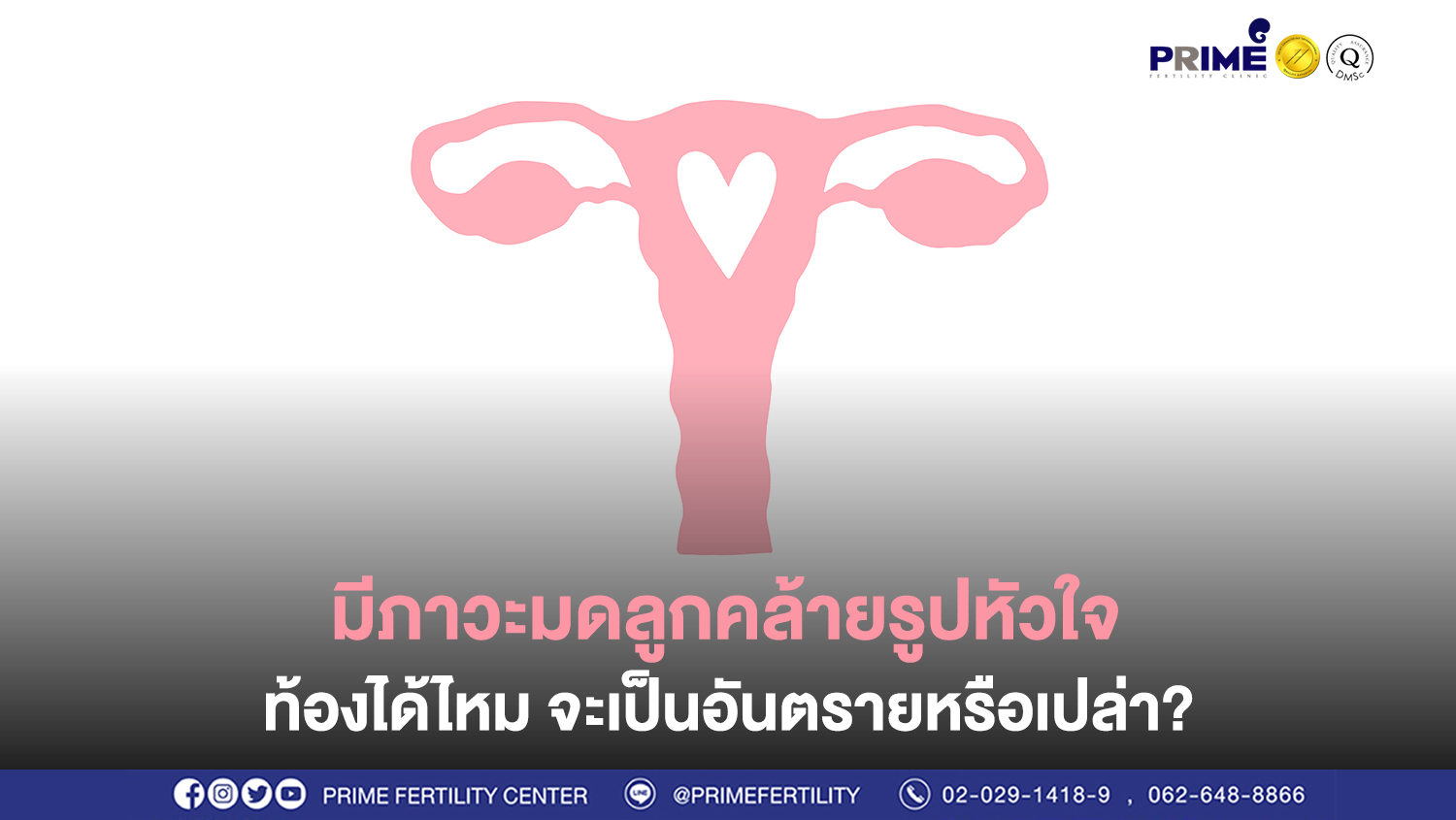 มีภาวะมดลูกคล้ายรูปหัวใจ ท้องได้มั้ย เป็นอันตรายหรือเปล่า web