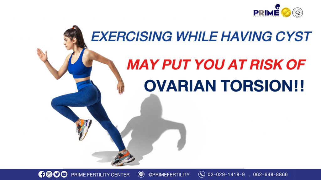 Exercising while having cyst may put you at risk of ovarian torsion - เป็นซีสต์ ออกกำลังกายมากไป อาจเสี่ยงรังไข่บิดขั้ว ขึ้นเว็บ เป็นซีสต์ ออกกำลังกายมากไป อาจเสี่ยงรังไข่บิดขั้ว ขึ้นเว็บ