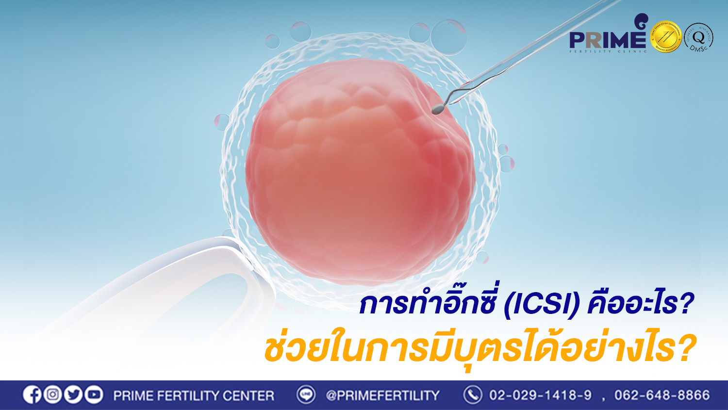 การทำอิ๊กซี่ ICSI คืออะไร ช่วยในการมีบุตรได้อย่างไร web