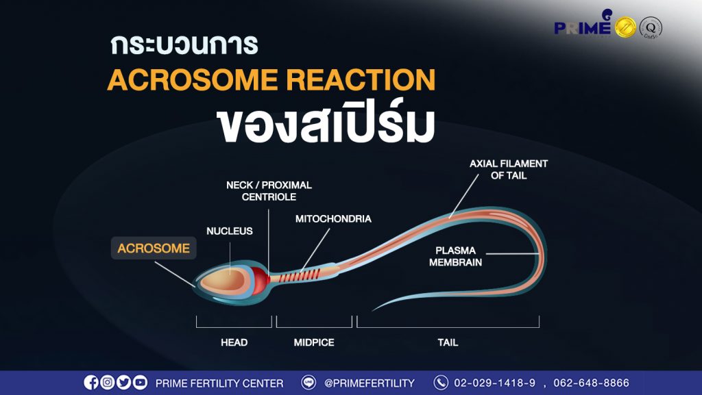 มีบุตรยาก