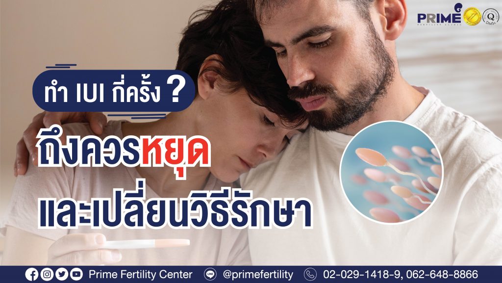 ทำ IUI กี่ครั้ง? ถึงควรหยุดและเปลี่ยนวิธีรักษา