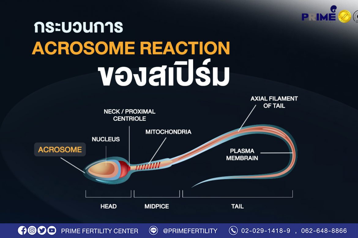 มีบุตรยาก