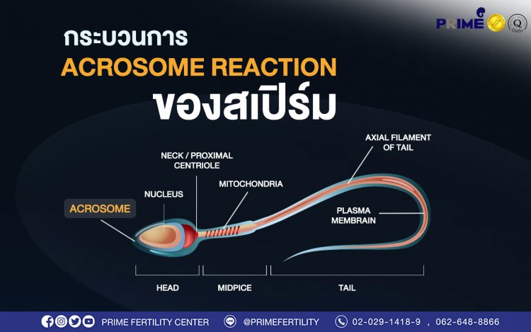 มีบุตรยาก