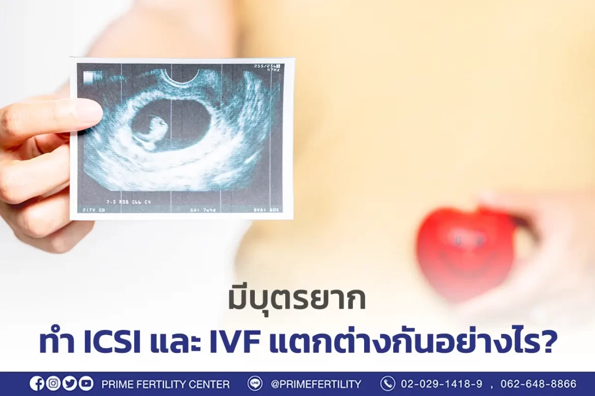 ICSI IVF แตกต่างกันอย่างไร?