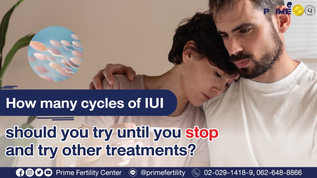 How many cycles of IUI should you try until you stop and try other treatments? - ทำIUI กี่ครั้งถึงควรหยุดและเปลี่ยนวิธีรักษา ปกเว็บ ทำIUI กี่ครั้งถึงควรหยุดและเปลี่ยนวิธีรักษา ปกเว็บ