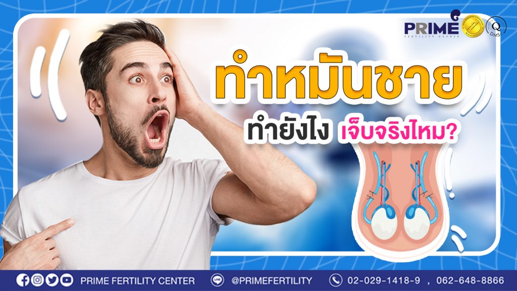 ทำหมันชาย ทำยังไง เจ็บจริงไหม?