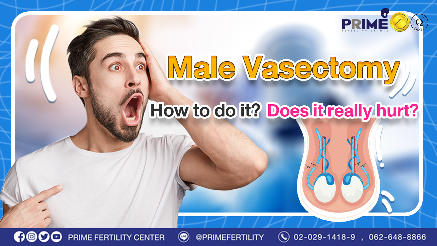 Male Vasectomy: How to do it? Does it really hurt?