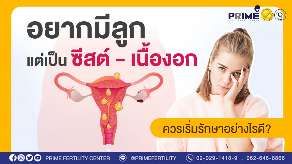 อยากมีลูก แต่เป็นซีสต์ เนื้องอก ควรเริ่มรักษาอย่างไรดี web