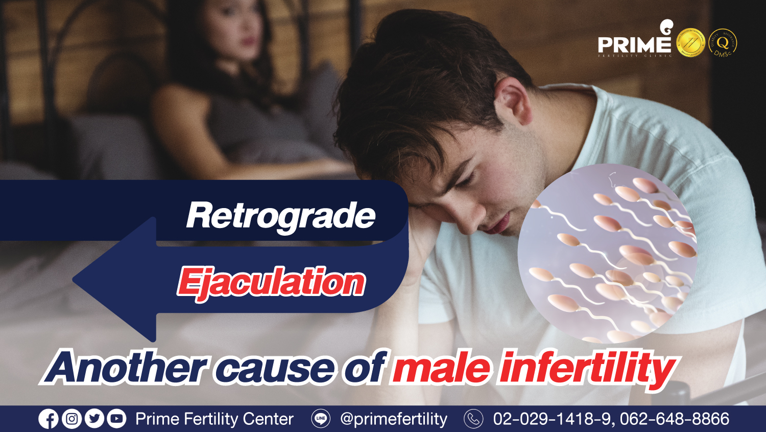 Retrograde Ejaculation (RE)