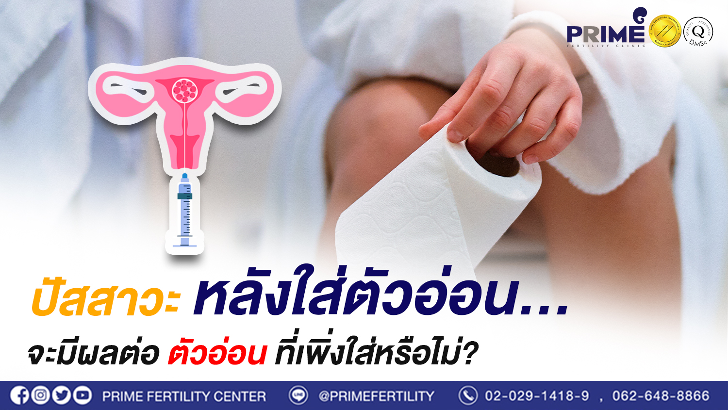 ปัสสาวะหลังใส่ตัวอ่อน...จะมีผลต่อตัวอ่อนที่เพิ่งใส่หรือไม่?