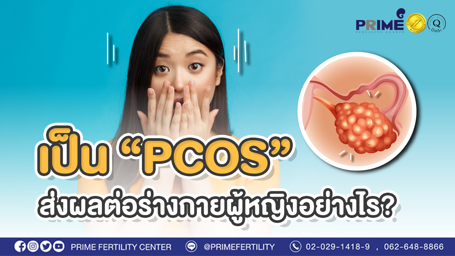 เป็น PCOS ส่งผลต่อร่างกายผู้หญิงอย่างไร?