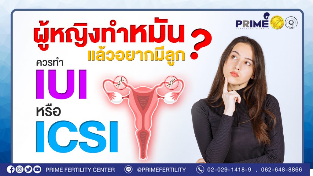 ผู้หญิงทำหมัน แล้วอยากมีลูก ควรทำ IUI หรือ ICSI ?