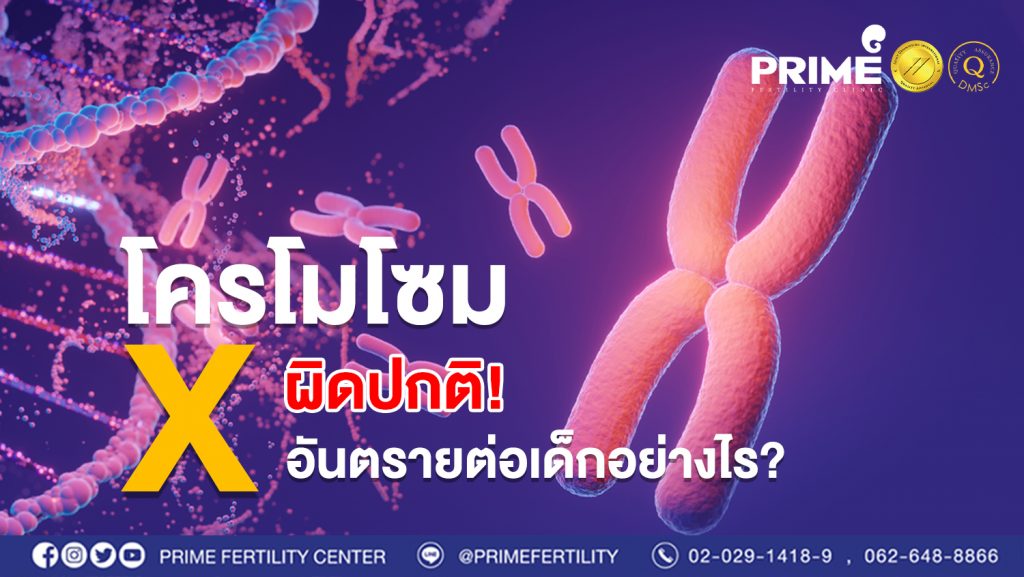 โครโมโซม X ผิดปกติ อันตรายต่อเด็กอย่างไร web