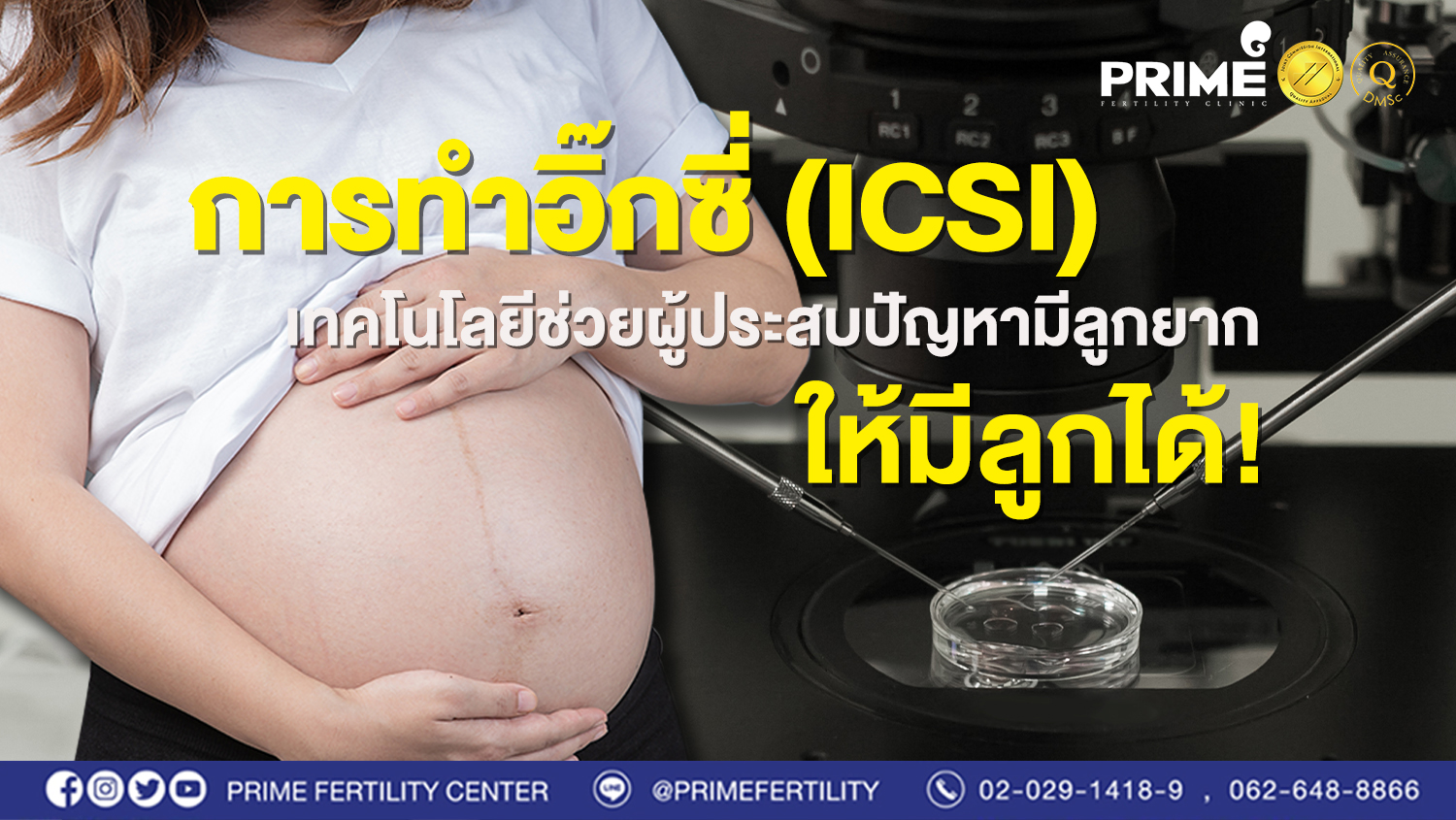 การทำอิ๊กซี่ (ICSI) เทคโนโลยีช่วยผู้ประสบปัญหามีลูกยาก ให้มีลูกได้